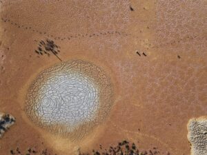 How Fatty Liver Disease Can Progress to More Severe Conditions Early Warning Signs